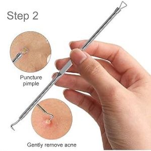 KIT REMOVEDOR DE ESPINILLAS, PUNTOS NEGROS